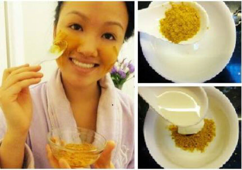 trị tàn nhang bằng sữa chua kết hợp nghệ